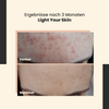 SkinTra - Light Your Skin - Serum mit Vitamin C 20% und Ferulasäure - 30ml
