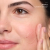 The Ordinary - Natural Moisturizing Factors + Beta Glucan - Feuchtigkeitscreme mit Beta Glucan - 30ml