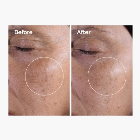 The Ordinary - Glycolic Acid 7% Exfoliating Toner - Peeling Gesichtswasser mit 7% Glykolsäure - 240ml