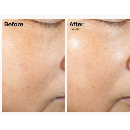 The Ordinary - Rice Lipids + Ectoin Microemulsion - Mikroemulsion mit Reis-Lipiden und Ectoin - 120ml
