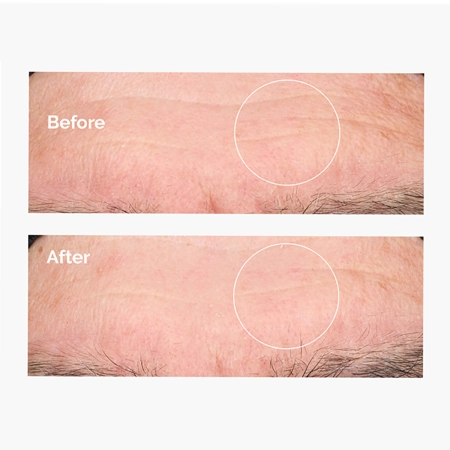 The Ordinary - Hyaluronic Acid 2% + B5 - Feuchtigkeitsspendendes Serum mit Hyaluronsäure 2% und Vitamin B5 - 60ml