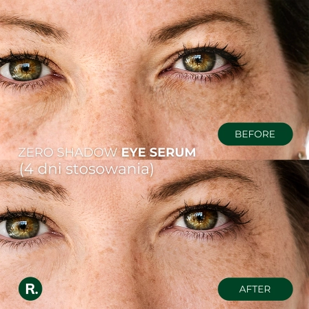 Ralls - Zero Shadow Eye Serum - Augenserum - 20 ml