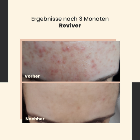 SkinTra - Reviver - Revitalisierendes Serum - 30ml