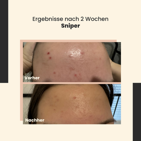 SkinTra - Sniper - Creme für Unvollkommenheiten - 20ml 