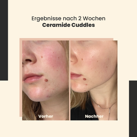 SkinTra - Ceramide Cuddles - Regenerierendes Serum - 30ml 