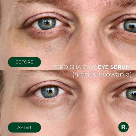 Ralls - Zero Shadow Eye Serum - Augenserum - 20 ml