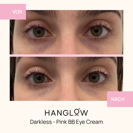 HanGlow - Darkless - Pink BB Eye Cream - Creme - Abdeckstift für die Unteraugenpartie - 15ml